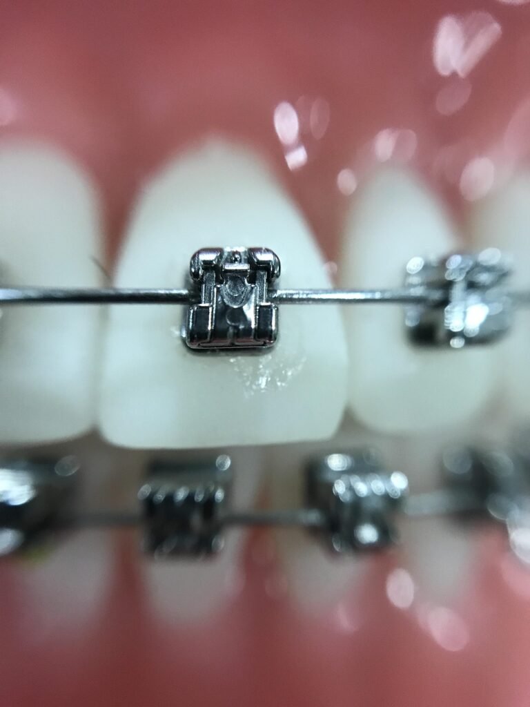 zoom, orthodontics, iphone, orthodontics, orthodontics, orthodontics, orthodontics, orthodontics